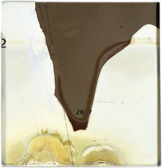 maria bonn nts #0604